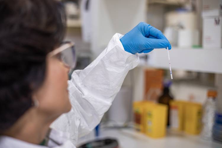 Butantan obtém patentes de dois testes rápidos para diagnóstico de leptospirose que oferecem resultados em 25 minutos