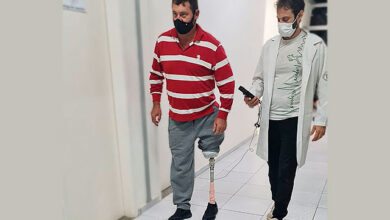 Protótipo de prótese de joelho desenvolvido pela Unesp é mais leve e barato que modelo usado no SUS