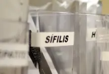 sifilis