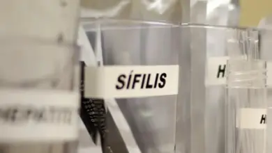 sifilis