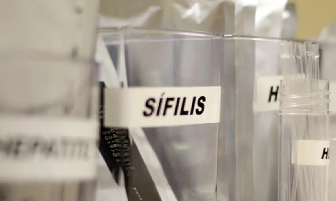 sifilis